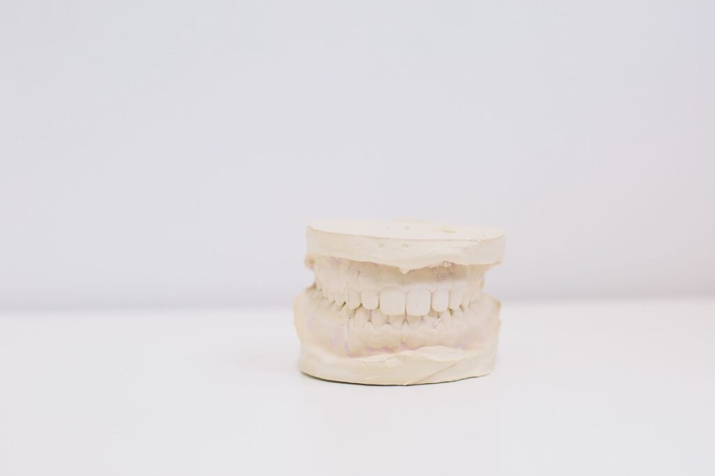 Modelo de yeso de una impresión dental sobre una mesa blanca